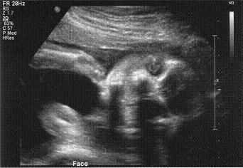 Baby’s Face 1