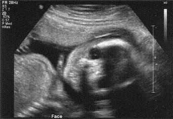 Baby’s Face 2