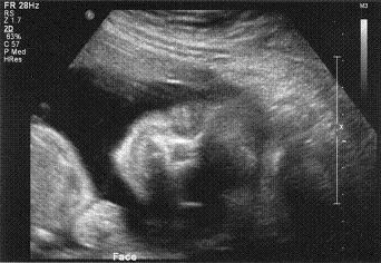 Baby’s Face 3